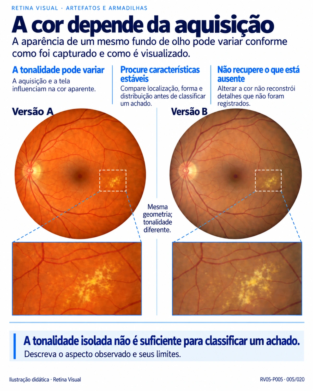 Amostra em português do material de Retina: Artefatos · limites da imagem.