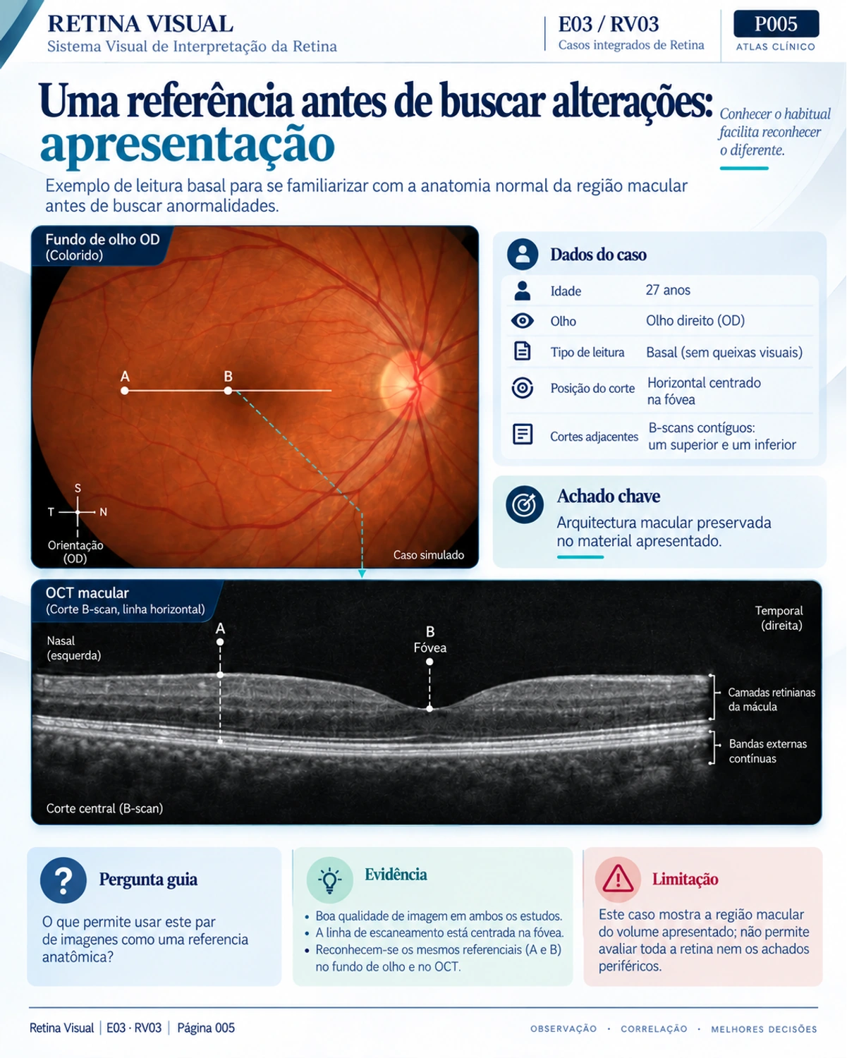 Amostra em português do material de Retina: Casos Integrados · página 5.