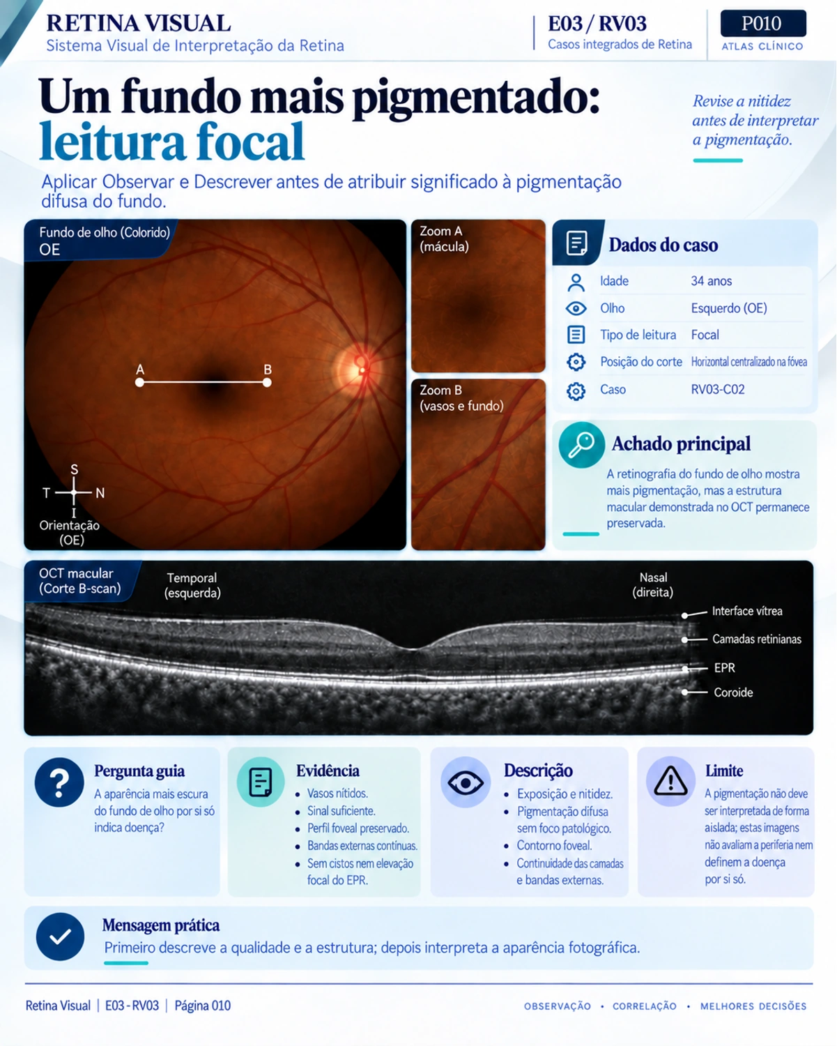 Amostra em português do material de Retina: Casos Integrados · página 10.