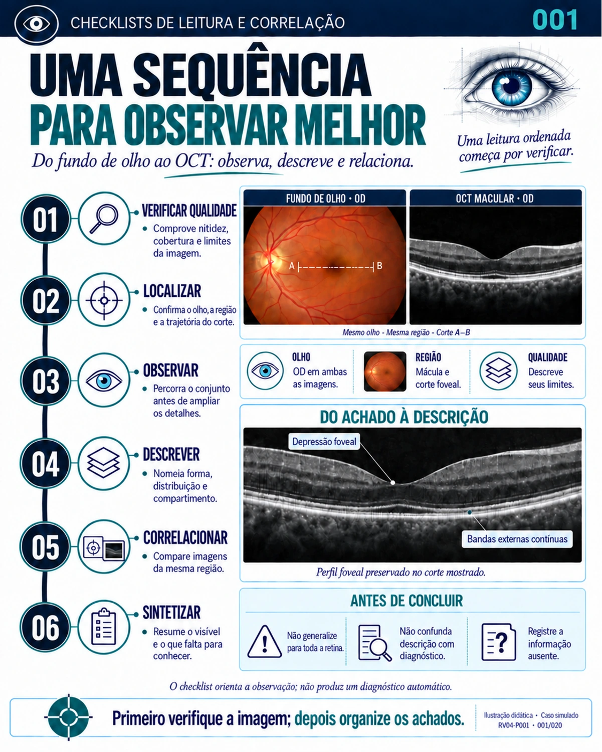 Amostra em português do material de Retina: Checklists · sequência de leitura.